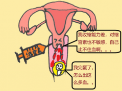 宫颈妊娠要做清宫手术吗 宫颈妊娠要做什么